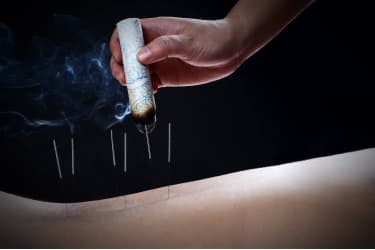 Moxibustion